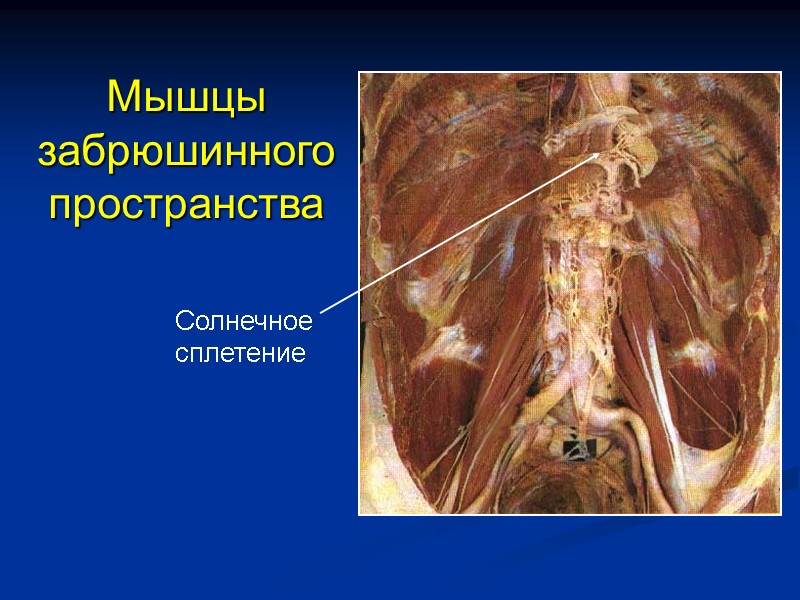 Мышцы забрюшинного пространства Солнечное сплетение